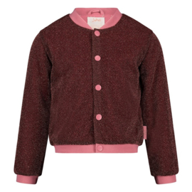 Jubel bomberjack roze glitter - Chic City