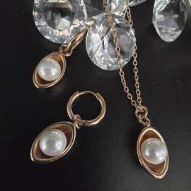Oorringen Pearlite
