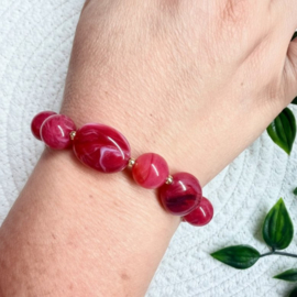 Ruby Passion - armband - acryl