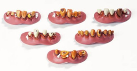 WM 2666 ( false teeth )