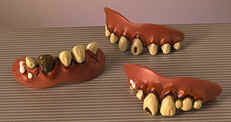 WM 2666 ( false teeth )