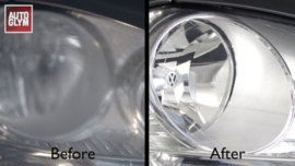 Autoglym Headlight Restoration Complete Kit