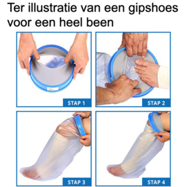 Gipshoes voet-enkel