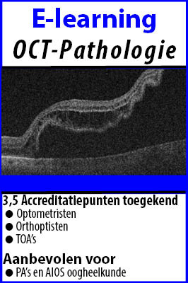 OCT-pathologie