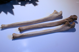 Human Bone: (part of an old medical skeleton) Ulna