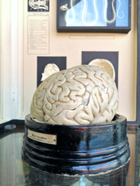 Anatomical brain model