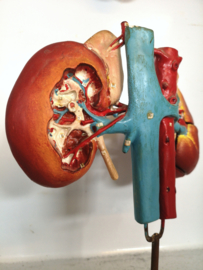 Anatomical plaster kidney model