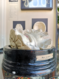 Anatomical brain model