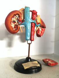 Anatomical plaster kidney model