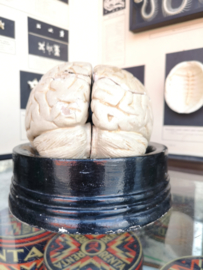 Anatomical brain model