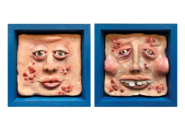 Tweeluik: Chemische peeling