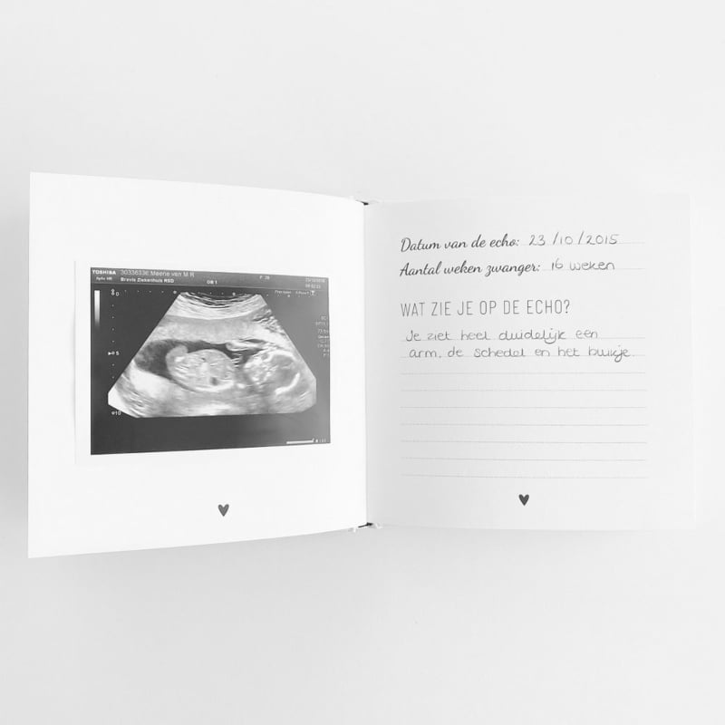 Echo Fotoboek voor de | Invulboeken/mijlpalen | Klein Konijn