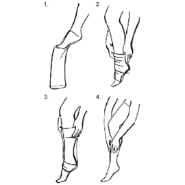 Steunpanty - compressiepanty met open teen - panty voor benen met spataderen - 280 den - nude (beige)