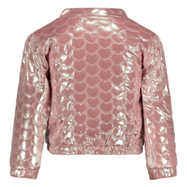 Bomberjack JUBEL roze Ciao bella 91300174