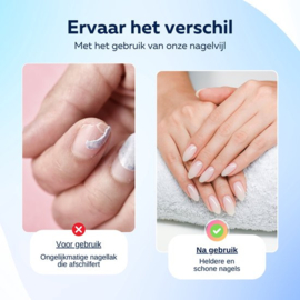 COCHO® Nagelfrees met nagelvijl bitjes - Pedicureset electrisch - Nagelvijl electrisch - Nagellak