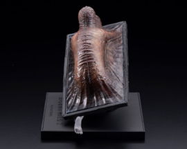 Silent Hill 2 Oshi Works Figure Abstract Daddy 15 cm - PRE-ORDER