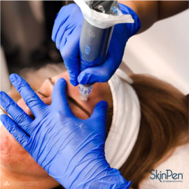 SkinPen Medische Microneedling