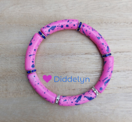 Tube armband ♡ Roze met blauw