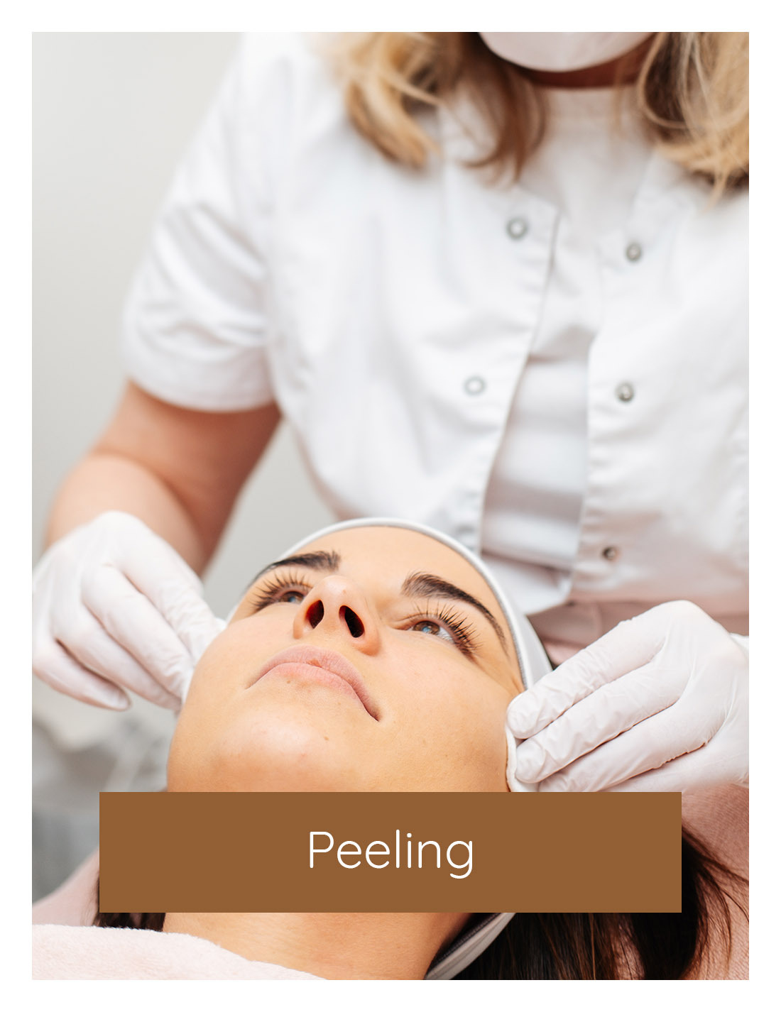 Peeling, chemische peeling, huid peeling, gezichtsbehandeling | Huidzaken