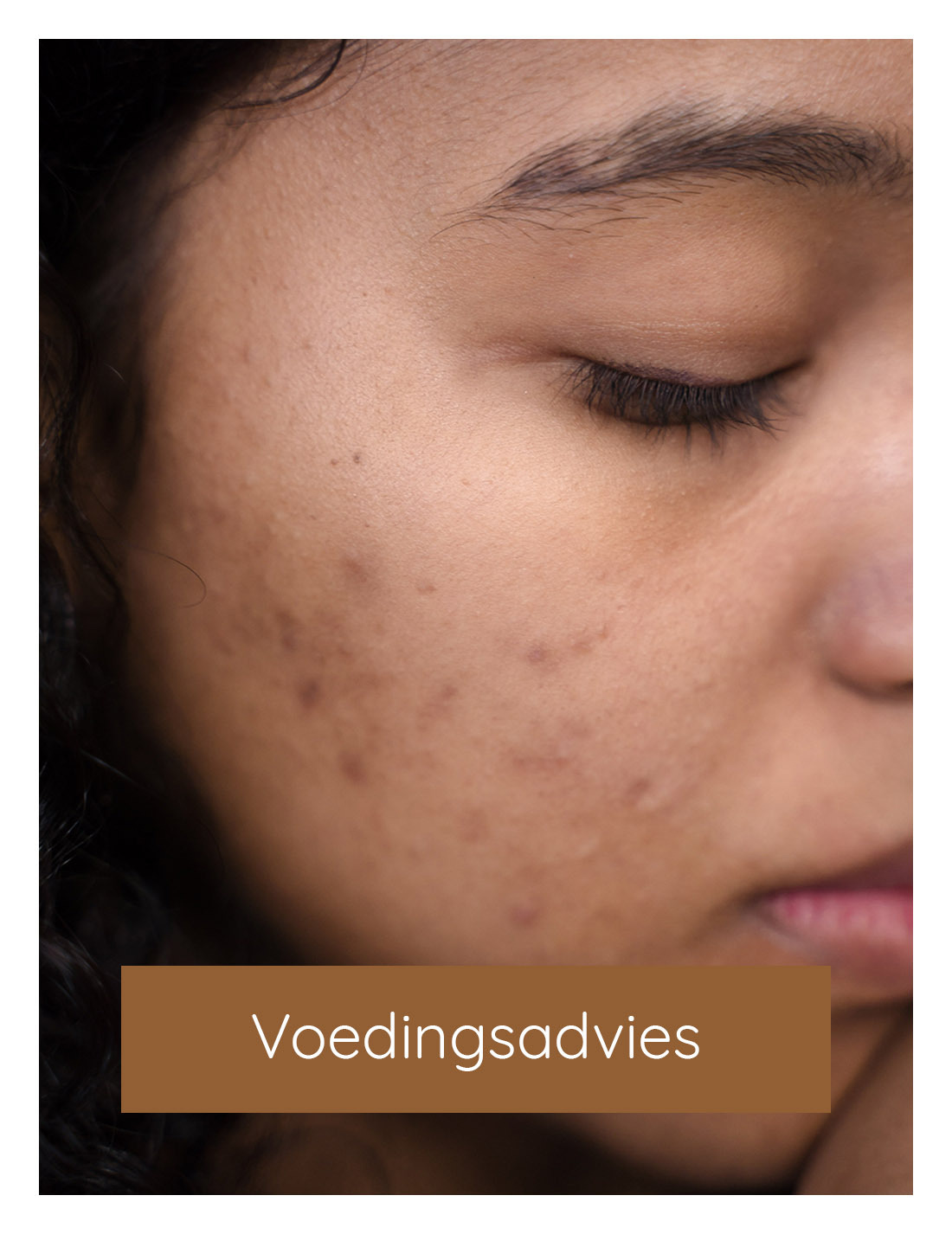 Voedingsadvies, huid en voeding | Huidzaken