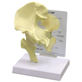 Anatomisch model Heup gewricht