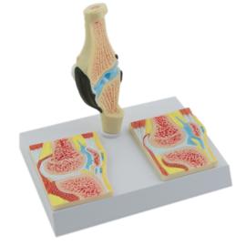 HEINE SCIENTIFIC Anatomisch model knie met reuma