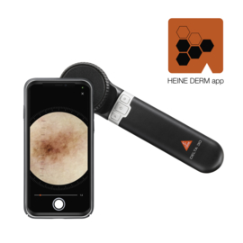 HEINE DELTA 30 dermatoscoop