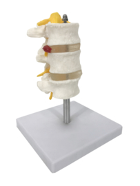Anatomisch model Wervelkolom (3 delen)