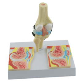 HEINE SCIENTIFIC Anatomisch model knie met reuma