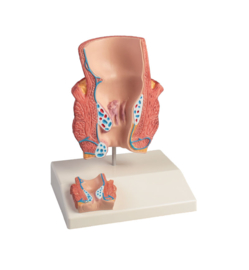 Anatomisch model Aambeien