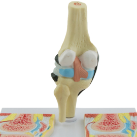 HEINE SCIENTIFIC Anatomisch model knie met reuma