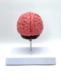 Anatomisch model van het brein met pathologieën