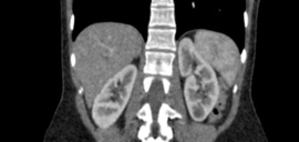 Erler Zimmer Onderbuik voor de training van CT, Röntgen- en radiotherapie