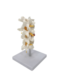 Anatomisch model Wervelkolom (4 delen)