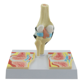 HEINE SCIENTIFIC Anatomisch model knie met reuma