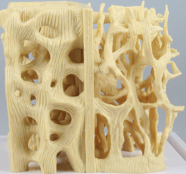 Osteoporose model