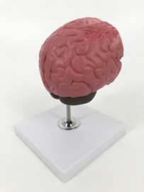 Anatomisch model Herseninfarct