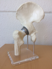 Anatomisch model Heup gewricht op transparante basis