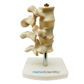 HEINE SCIENTIFIC Anatomisch model wervels met osteoporose
