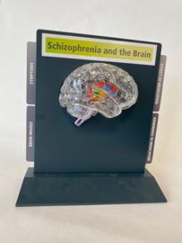 Schizofrenie model (transparant hersen helft)