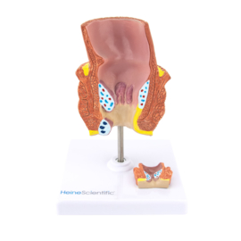 HEINE SCIENTIFIC Anatomisch model rectum met aambeien