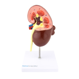 HEINE SCIENTIFIC Anatomisch model nier met ziektebeelden