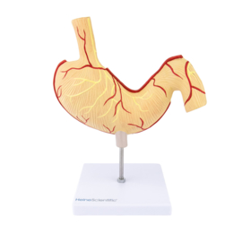 HEINE SCIENTIFIC Anatomisch model maag met zweren