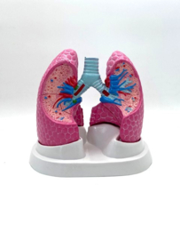 Anatomisch model van de longen met pathologieën