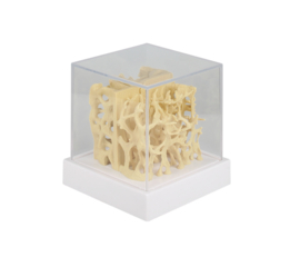 Osteoporose model