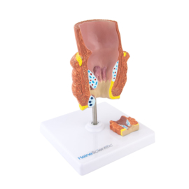 HEINE SCIENTIFIC Anatomisch model rectum met aambeien