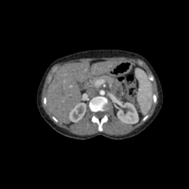 Erler Zimmer Onderbuik voor de training van CT, Röntgen- en radiotherapie