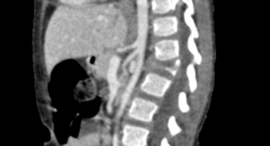 Erler Zimmer Onderbuik kind voor de training van CT, Röntgen- en radiotherapie