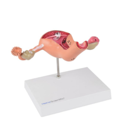 HEINE SCIENTIFIC Anatomisch model baarmoeder met ziektebeelden
