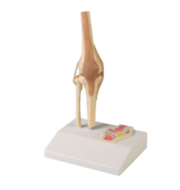 Anatomisch model Knie gewricht met dwarsdoorsnede